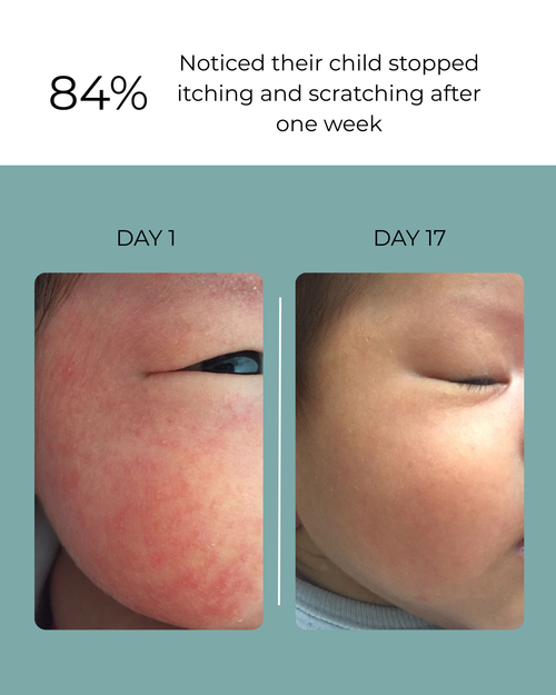 Universal Soft Water Bath Purifier